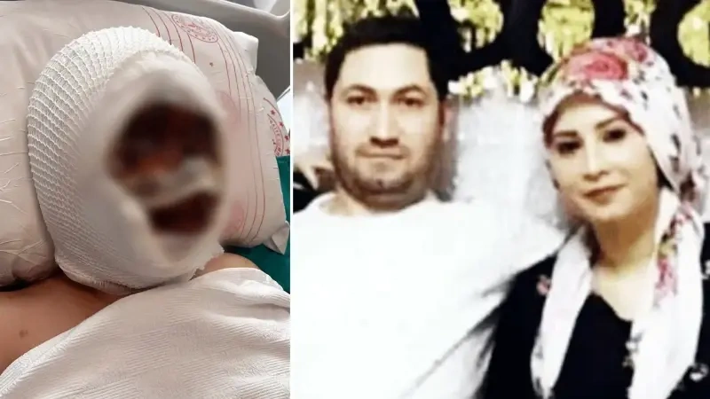 Eşini bağlayıp başından kezzap döktü: Kadın kör oldu