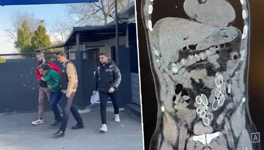 Fas'tan midesinde uyuşturucu getirdi: 49 kapsül esrar çıktı