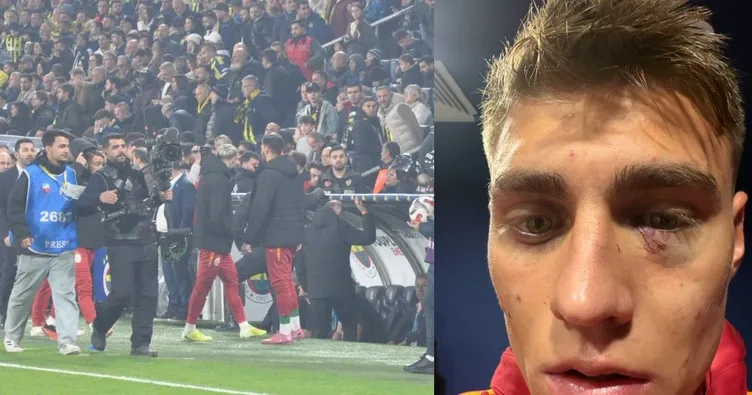 Kazımcan'a çakmak atan taraftar yakalandı