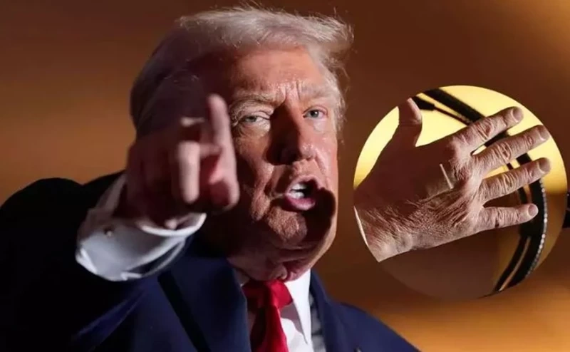 Trump'ın sağ elindeki bandaj merak uyandırdı: Sağlık durumu tartışılıyor