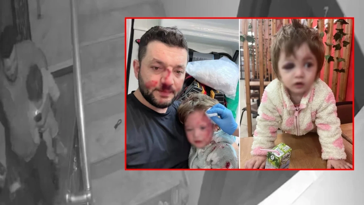 Yalova'da 14 aylık bebeğe saldırı: İddianame hazırlandı