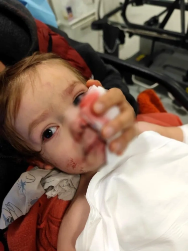 Ankara'da pitbull saldırısı: Köpek sahibi tutuklandı