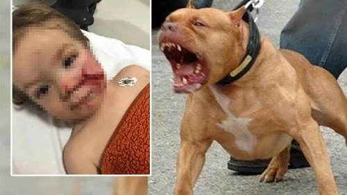 Ankara'da pitbull saldırısı: Köpek sahibi tutuklandı