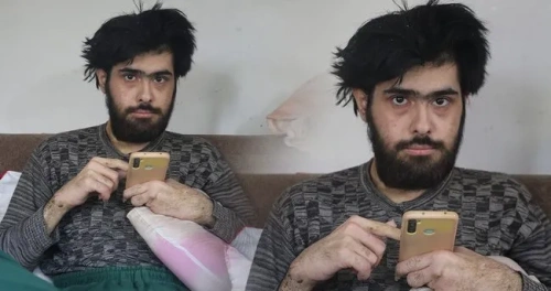 Deprem sonrası hayata küstü: 3 yıldır evden çıkmıyor, duş almıyor