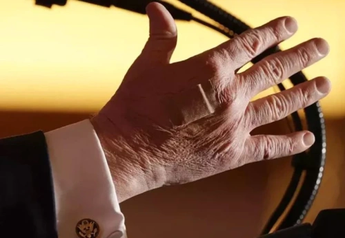 Trump'ın sağ elindeki bandaj merak uyandırdı: Sağlık durumu tartışılıyor