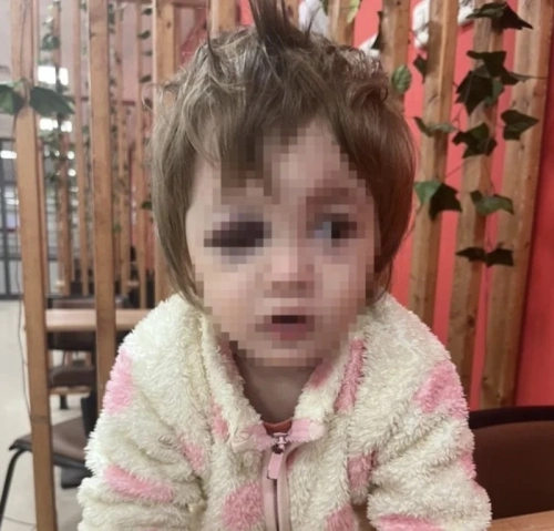 Yalova'da 14 aylık bebeğe sopalı saldırı: Şüpheli tutuklandı, Bakan Gürlek devreye girdi