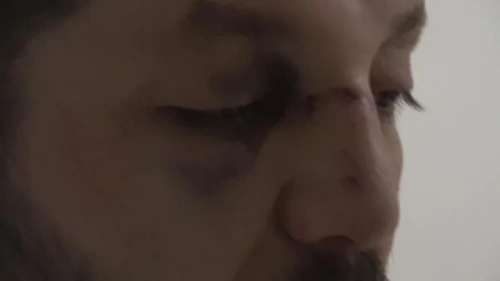 Yalova'da 14 aylık bebeğe sopalı saldırı: Şüpheli tutuklandı, Bakan Gürlek devreye girdi